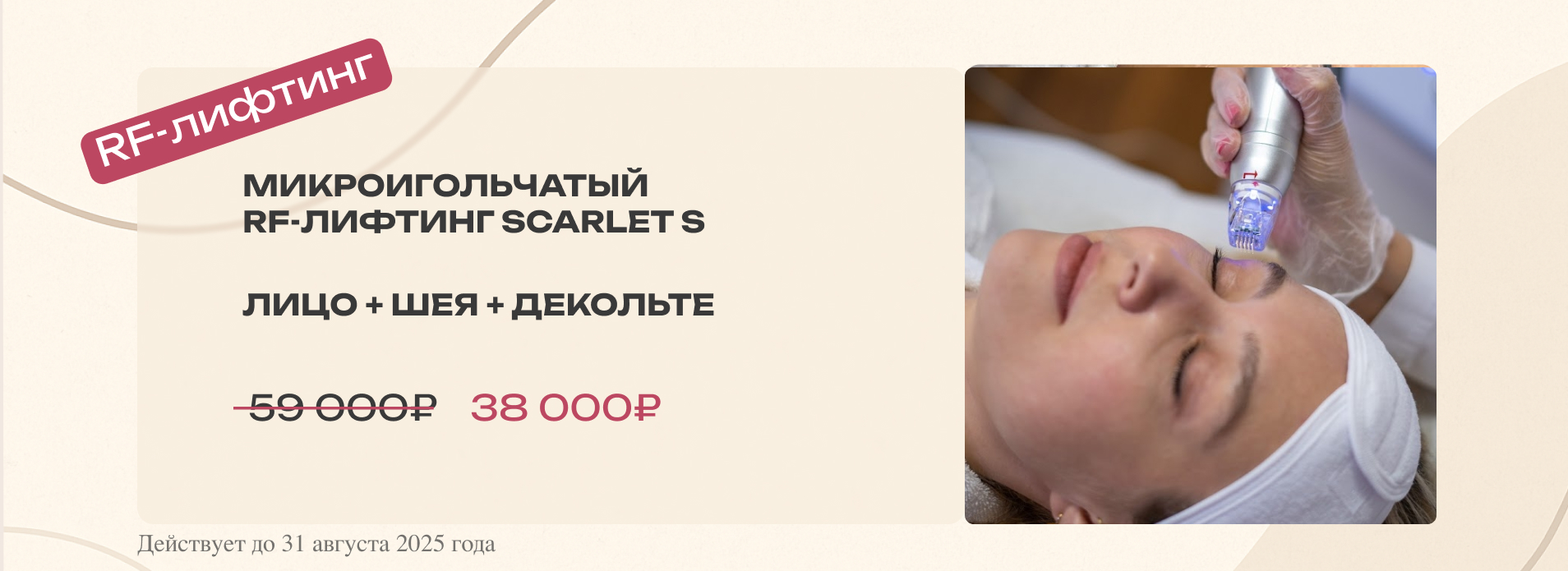 RF-лифтинг