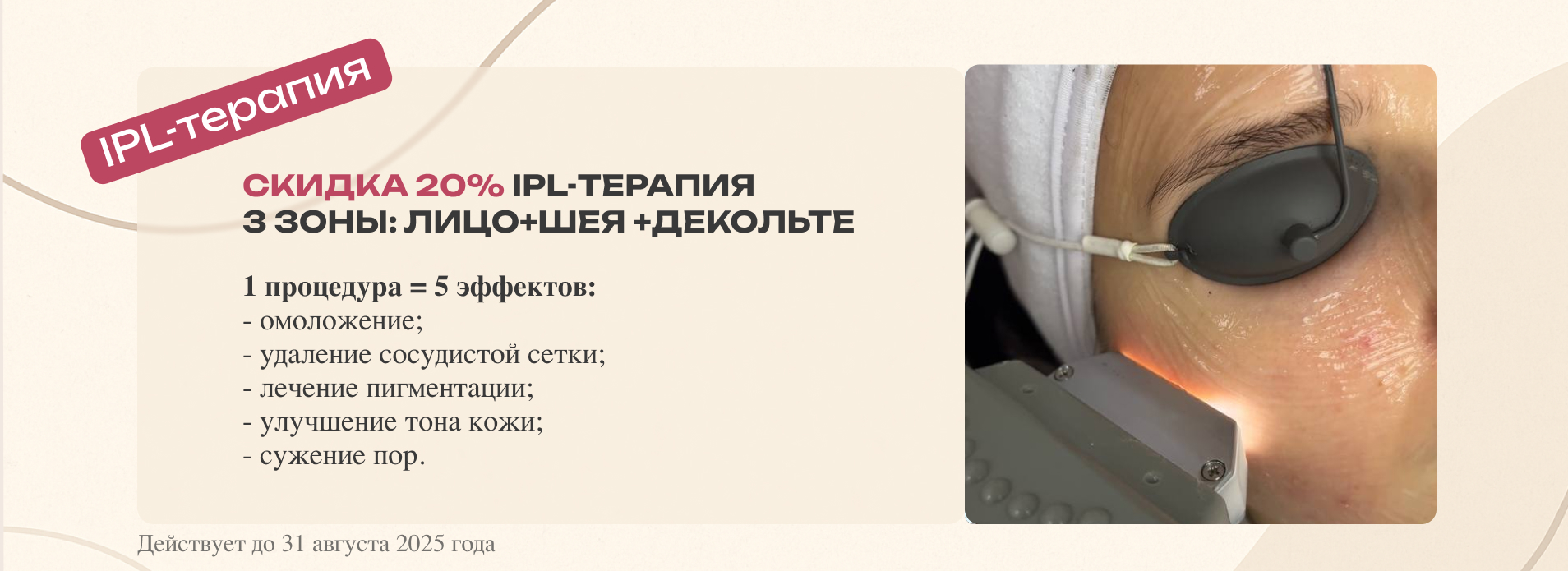 IPL-терапия